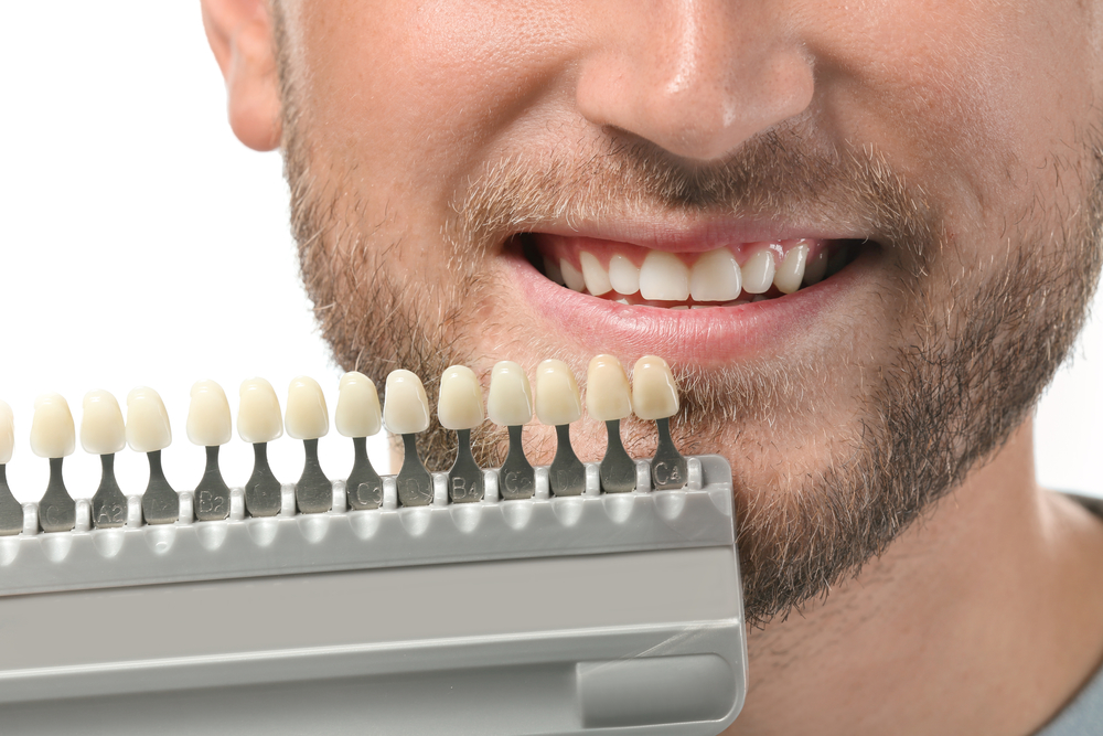 man with discolored teeth